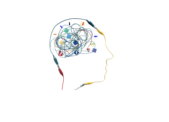 Image of a head with a brain made out of colorful wires.
