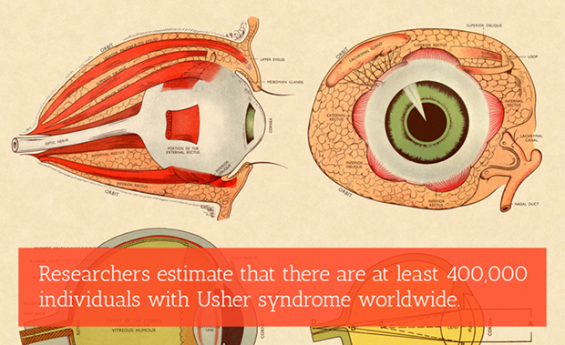 Diagram of an eye with various parts labelled. Text overlay reads "Researchers estimate that there area t least 400,000 individuals with Usher syndrome worldwide."