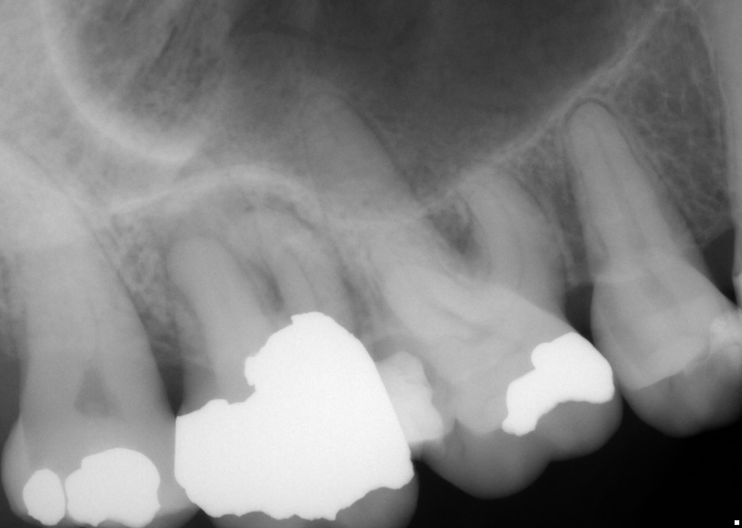Cornerstone Endodontics Referring Doctors Jamie's Endo Journal Journal Archive