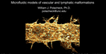 Microfluidic Models of Vascular and Lymphatic Malformations