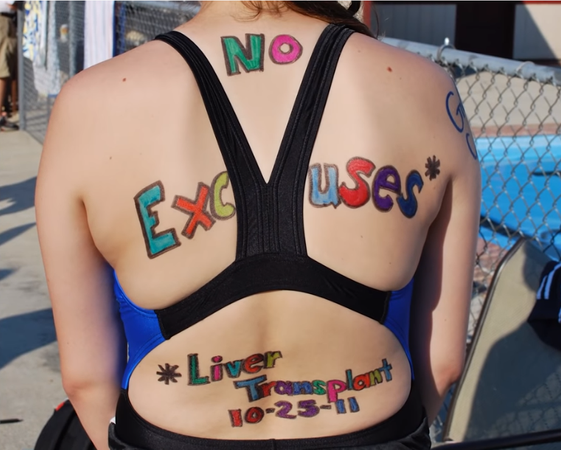 You see the back of a woman wearing a bathing suit. Written on her back in colorful letters is No Excuses. Liver Transplant 10-25-11