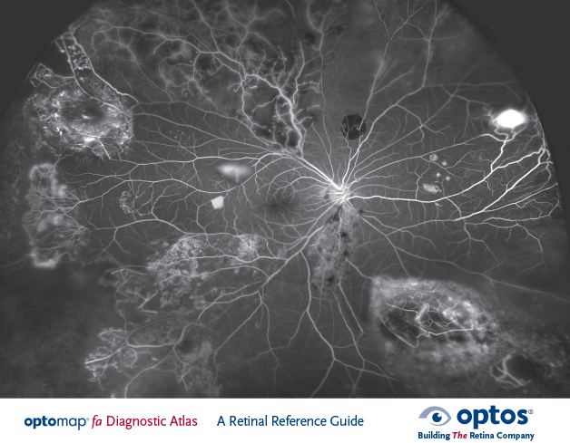 optomap Diagnostic Atlas Retinal Reference Guide (fa)