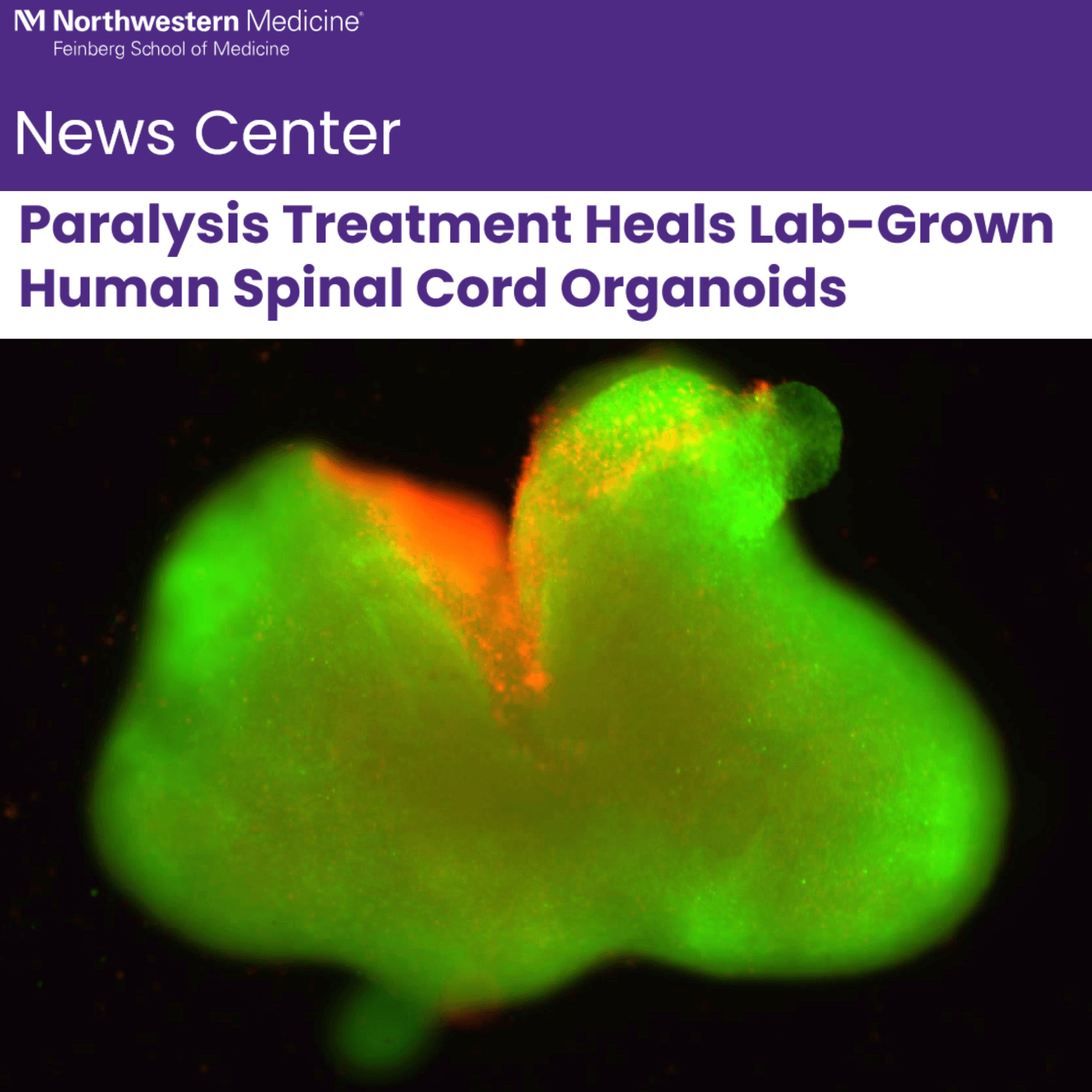 Headline Patrol: Stupp’s Supramolecules, Dancing In a Lab Dish