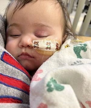 Outpatient baby with nasal feeding tube.