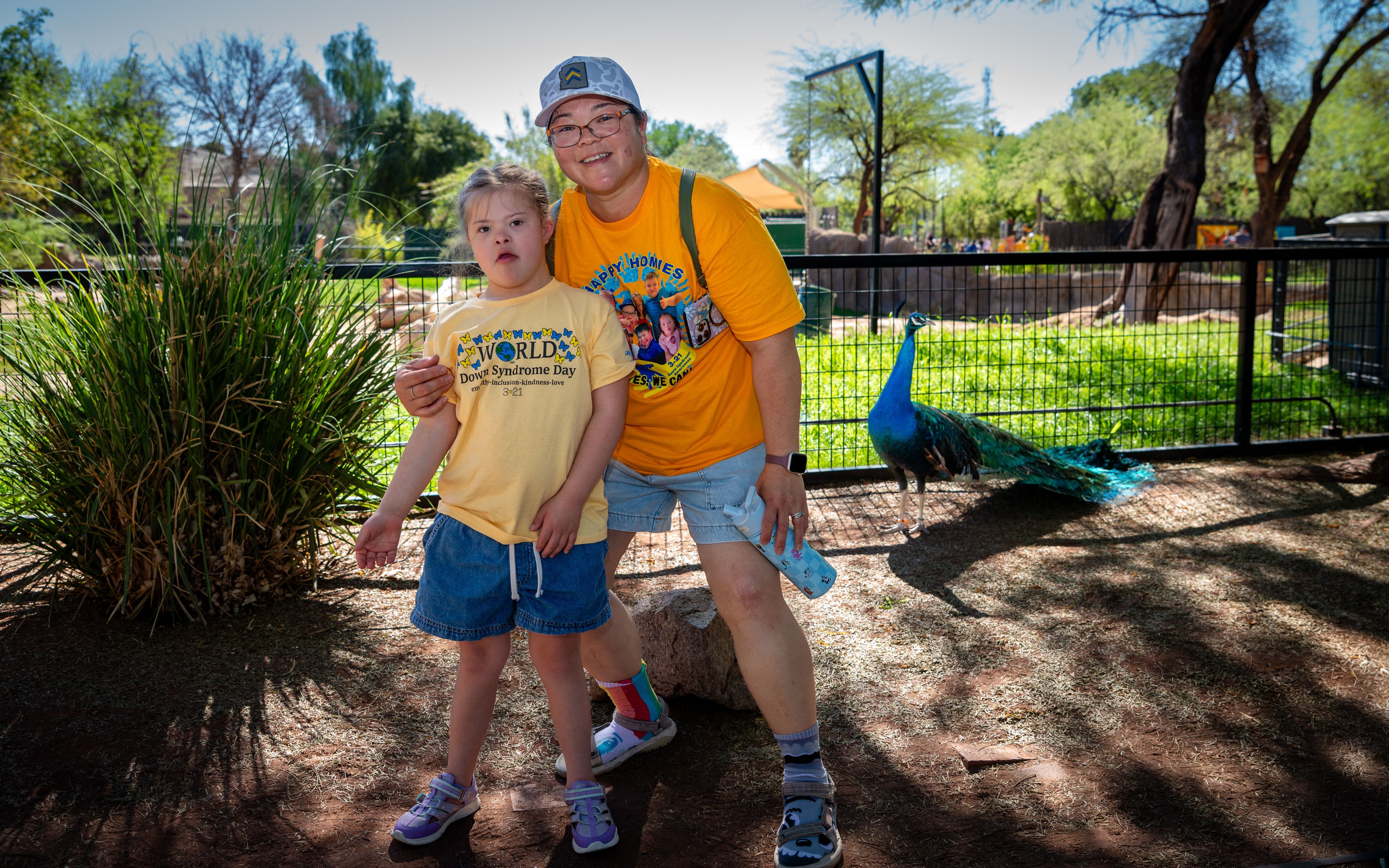 Step 2: Learn about Down syndrome & SANDS