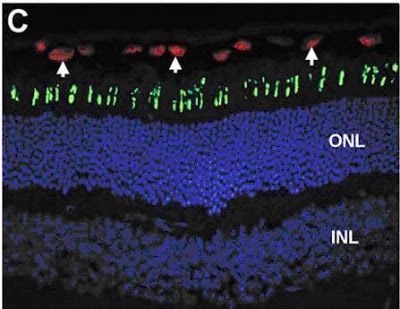 This is a picture of Opsin Protein