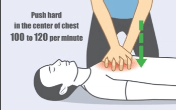 Why Hands Only CPR Works!