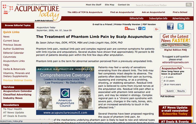 The Treatment of Phantom Limb Pain by Scalp Acupuncture