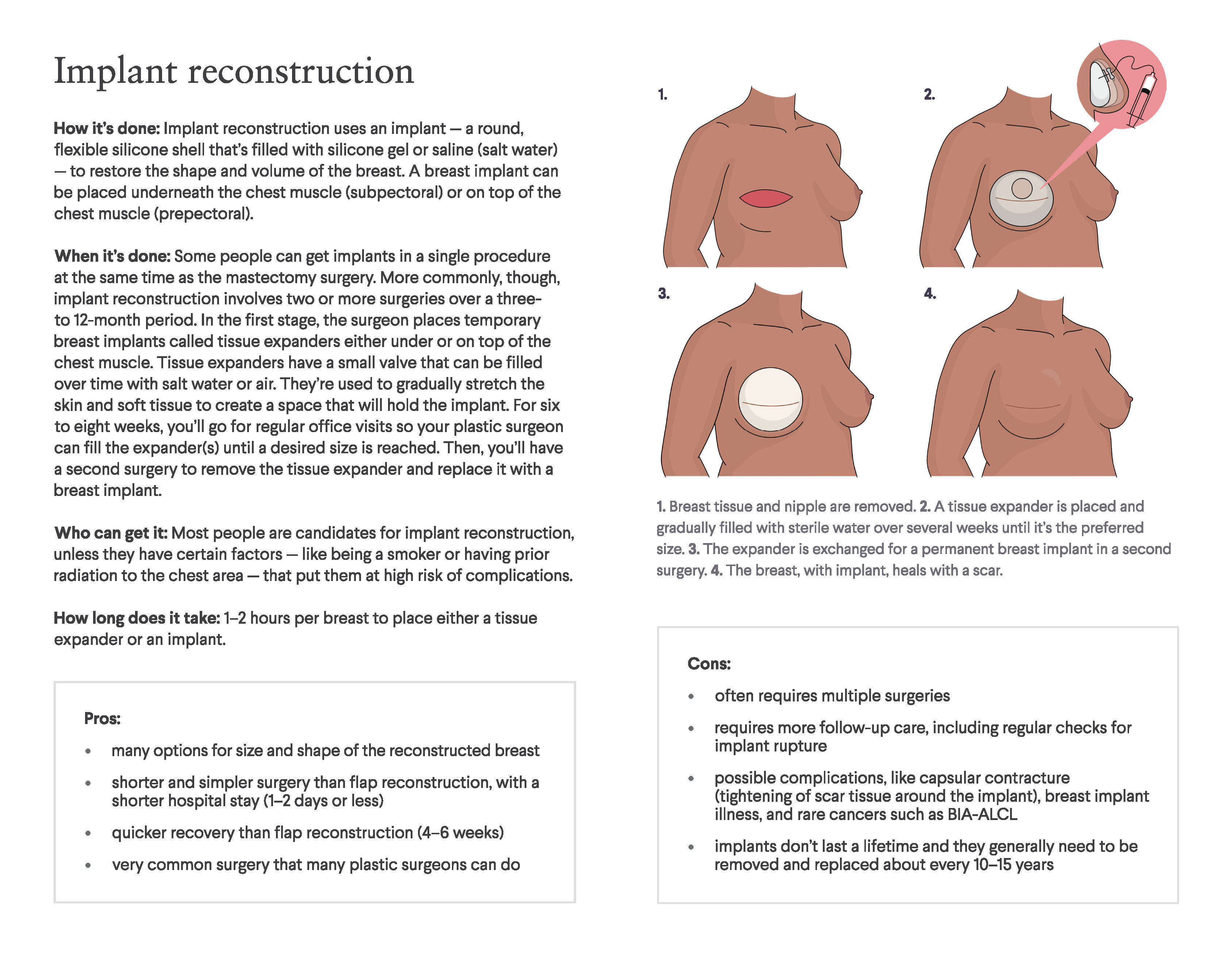 Breast Reconstruction: A Guide to Your Options