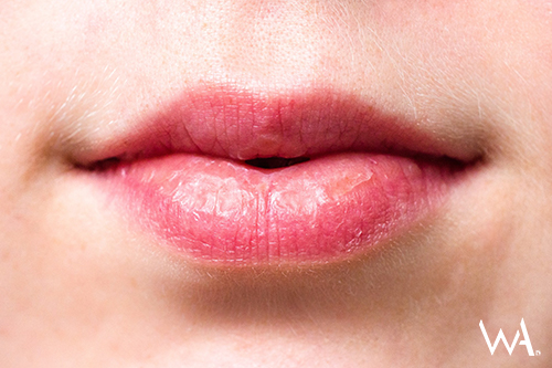 How diet impacts your skin