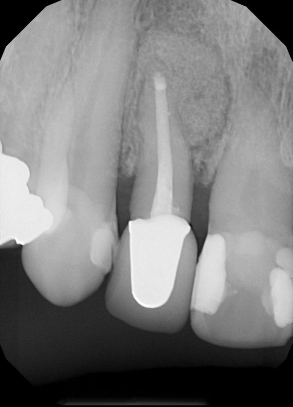 Journal Archive Jamie's Endo Journal Referring Doctors Cornerstone Endodontics