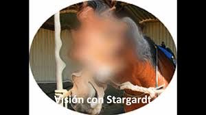 Stargardt's Disease