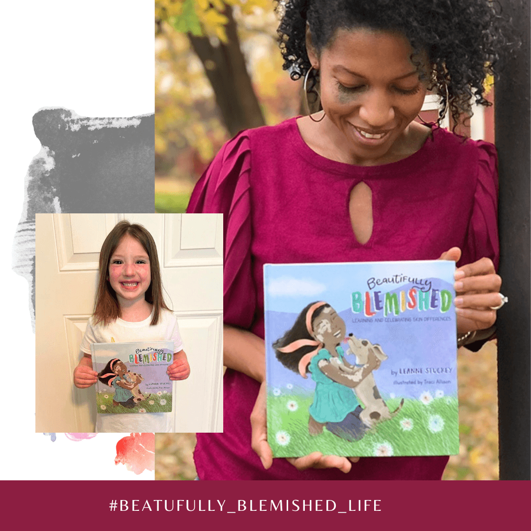 Beautifully Blemished author holding her book, leaning against a tree with her head down looking at book. Second smaller photo shows a little girl smiling at the camera holding the book.